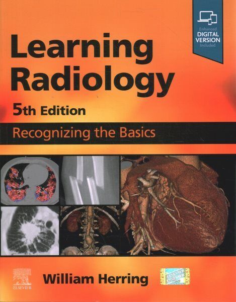 Learning Radiology : Recognizing The Basic