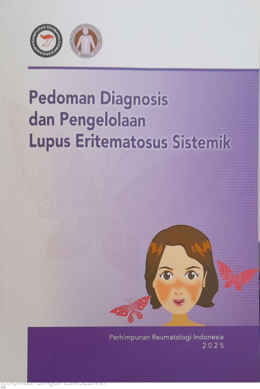 Pedoman Diagnosis Dan Pengelolaan Lupus Eritematosus Sistemik