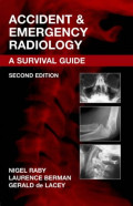 Accident & Emergency Radiology 2E