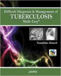 Difficult Diagnosis And Management Of Tuberculosis