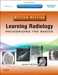 Learning Radiology Recognizing The Basics