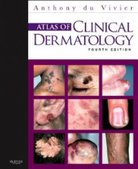 Atlas Of Clinical Dermatology 4E