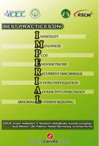 Best Practices On Imperial