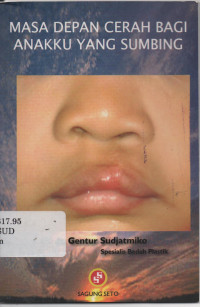 Masa Depan Cerah bagi Anakku yang Sumbing
