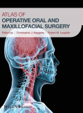 Atlas Operative Oral And Maxillofacial Surgery