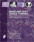 Bone And Soft Tissue Tumors : A Multidisciplinary Review With Case Presentation