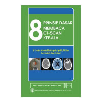 8 Prinsip Dasar Membaca CT Scan Kepala