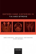 Oxford Case Histories in TIA and Stroke