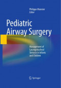 Pediatric Airway Surgery: Management of Laryngotracheal Stenosis in Infants and Children