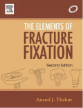 The Elements of Fracture Fixation