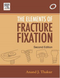 The Elements of Fracture Fixation