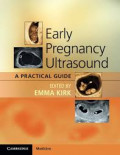 Early Pregnancy Ultrasound : A Practical Guide