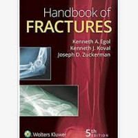 Handbook Of Fractures