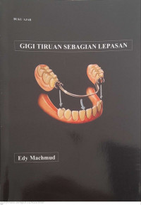 Buku Ajar Gigi Tiruan Sebagian Lepasan