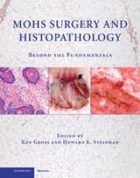 Mohs Surgery And Histopathology