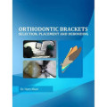 Orthodontic Brackets Selesction, Placement and Debonding