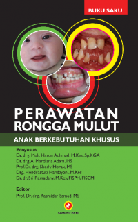 Perawatan Rongga Mulut Anak Berkebutuhan Khusus