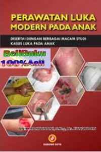 Perawatan Luka Modern Pada Anak