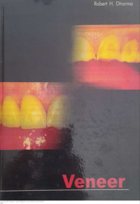 Veneer