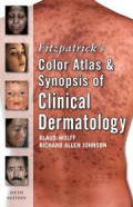 Fitzpatrick's Color Atlas and Synopsis of Clinical Dermatology: Sixth Edition