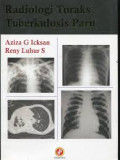 Radiologi Toraks Tuberkulosis Paru