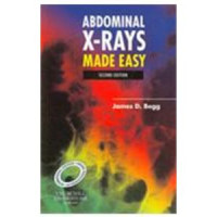 Image of Abdominal X-Rays Made Easy, 2e
