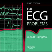 Image of 150 ECG Problems 3rd Ed.