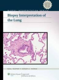 Image of Biopsy Interpretation The Lung