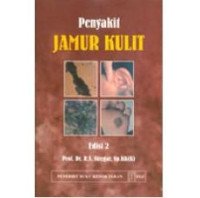 Image of Penyakit Jamur Kulit