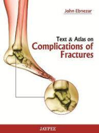 Image of Text & Atlas On Complications Of Fractures