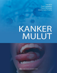 Image of Kanker Mulut