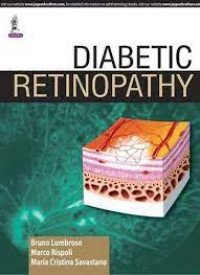 Image of Diabetic Retinopathy