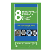 Image of 8 Prinsip Dasar Membaca CT Scan Kepala