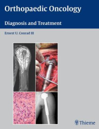 Image of Orthopaedic Oncology