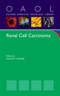 Image of Renal Cell Carcinoma