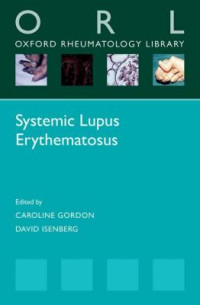 Image of Systemic Lupus Erythematosus