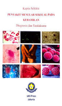 Image of Infeksi Menular Seksual