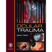Image of Ocular trauma