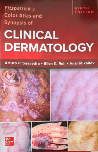 Image of Fitzpatrick's Color Atlas And Synopsis Of Clinical Dermatology