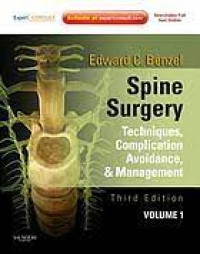 Image of Spine Surgery Techniques, Complication Avoidance, And Management