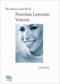 Image of The Science Porcelain Laminate Vaneers