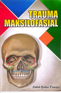 Image of Trauma Maksilofasial