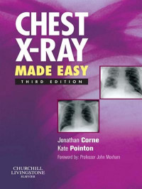 Image of Chest X-Ray Made Easy