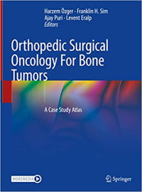 Image of Orthopedic Surgical Oncology For Bone Tumors