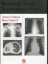 Image of Radiologi Toraks Tuberkulosis Paru